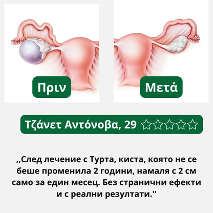 Ταγέτης – βάμμα 50 ml - για κύστεις, ινομυώματα και πολύποδες